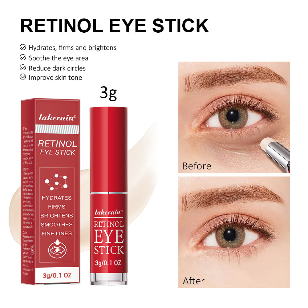 Retinol Eye Cream Stick – Anti-Aging, Dark Circle & Puffiness Treatment