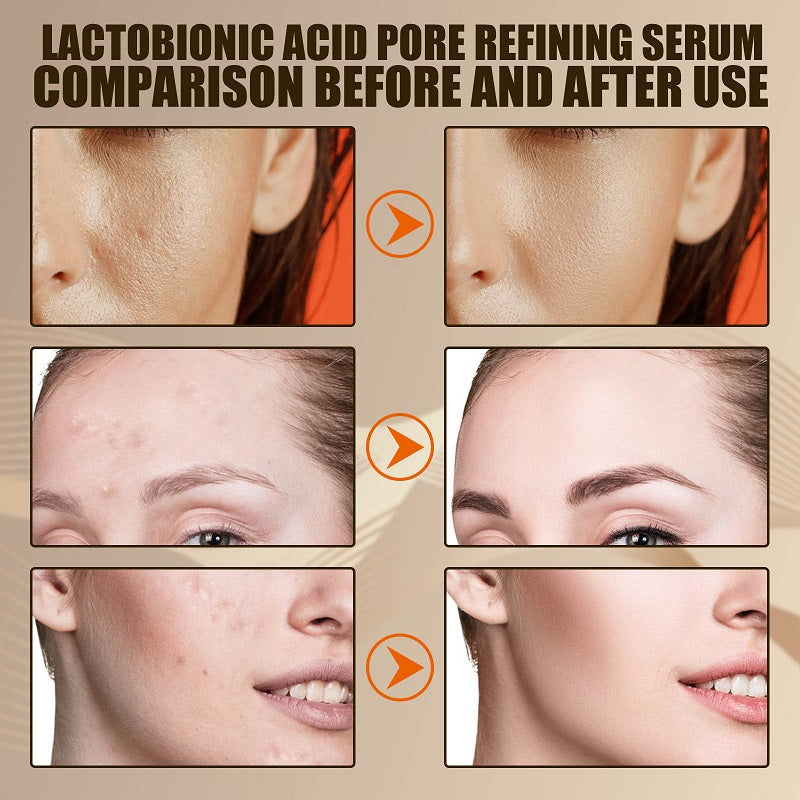 Lactobionic Acid Facial Serum