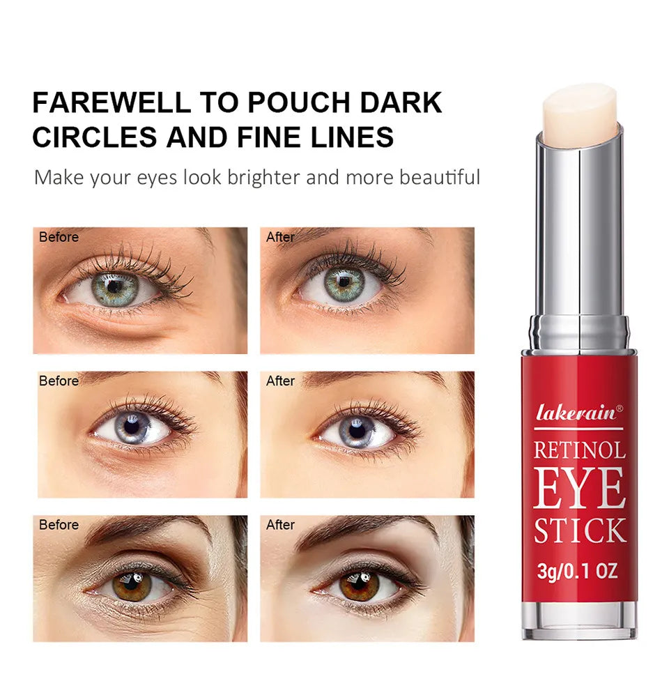 Retinol Eye Cream Stick – Anti-Aging, Dark Circle & Puffiness Treatment