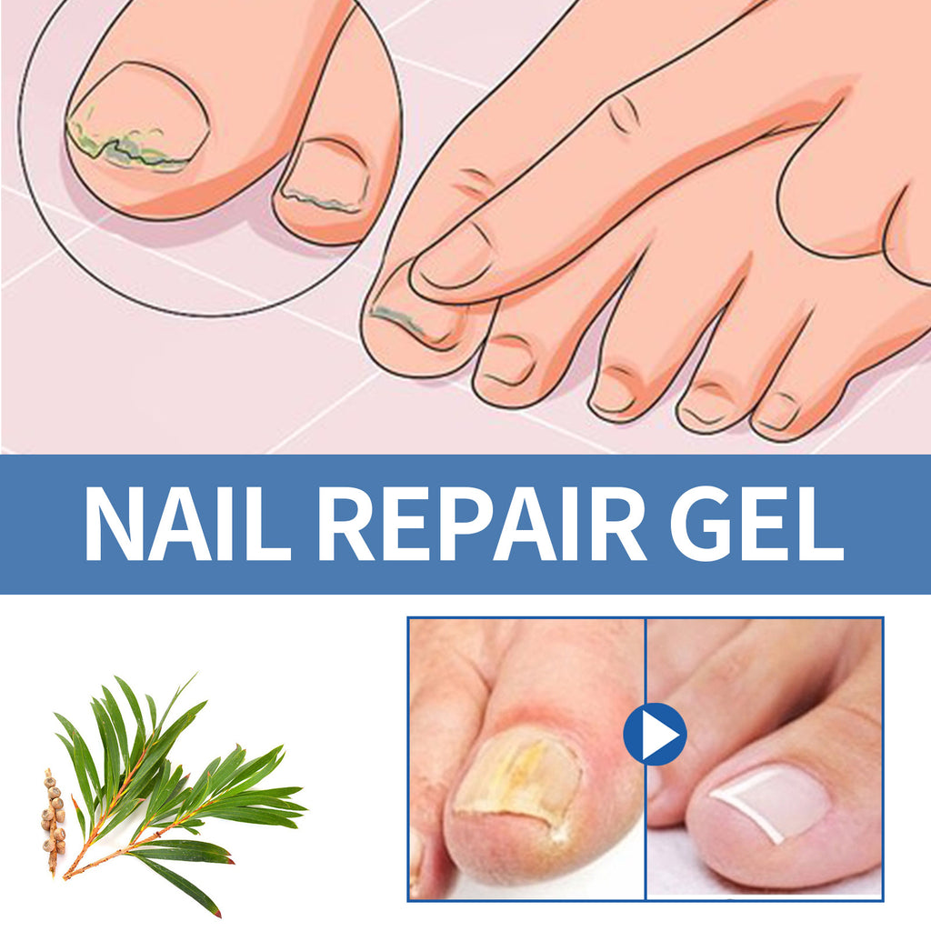 OUHOE Nail Care Gel, 20 g